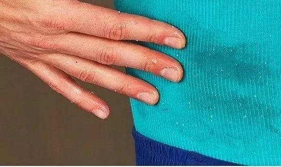 衣服发黄用什么漂白剂比较好,用漂白剂把白色衣服漂黄了怎么办