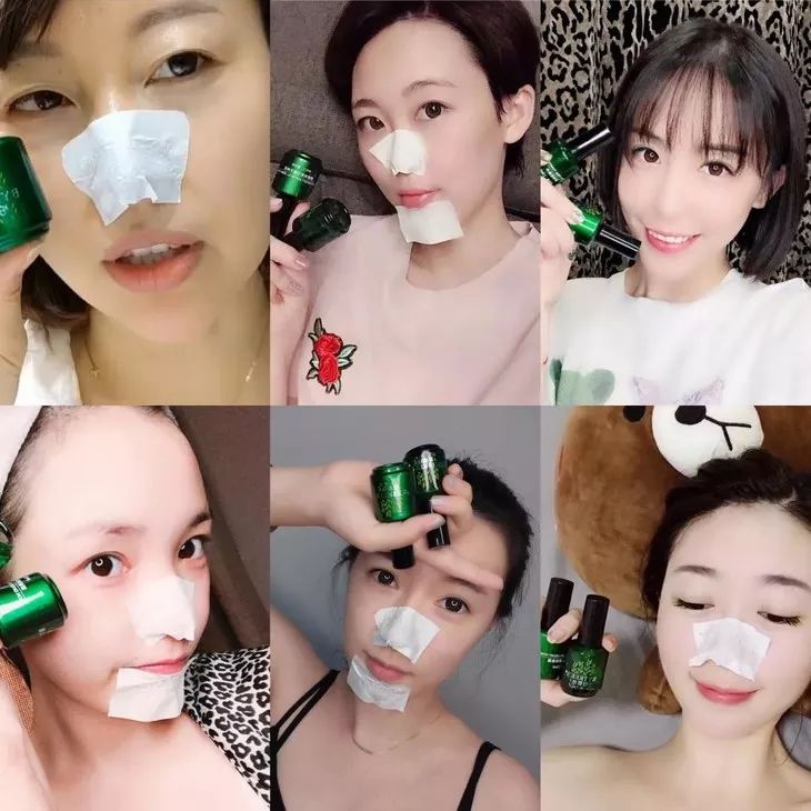 白头黑头到底拔不拔,黑头反反复复如何根治