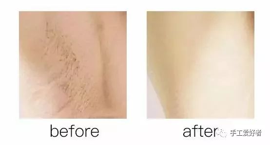 平价又好用的脱毛神器学生党温和,英国脱毛最好的产品适合学生党