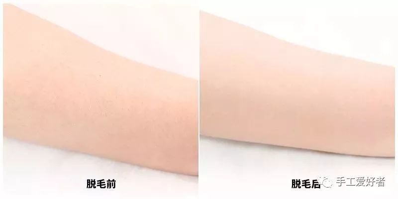 平价又好用的脱毛神器学生党温和,英国脱毛最好的产品适合学生党