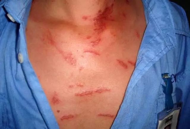 信阳市虫子,信阳常见的虫子