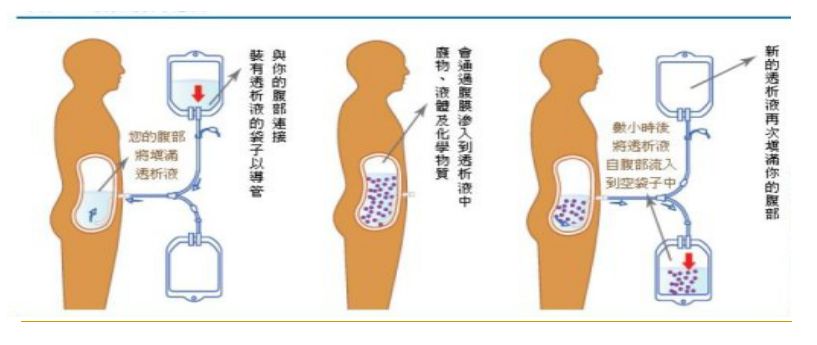 科普肾脏,医学科普出汗和肾脏关系