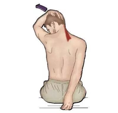 为什么挤痘痘会挤进icu,挤掉痘痘后留了个洞