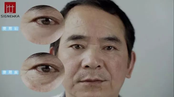 德国变态震动棒，啪啪啪间抚平眼袋、黑眼圈！不用开刀，就能让你年轻十岁！