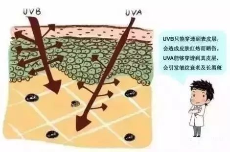 皮秒激光和调q激光哪个先进,皮秒激光消除色素沉着有效吗