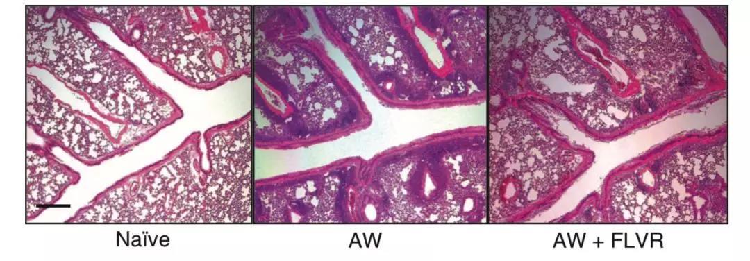 世界防治哮喘日关爱每位哮喘患儿,世界上儿童哮喘发病率