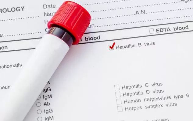 乙肝五项化验单只有核心抗体阳性,如何看懂乙肝五项化验单