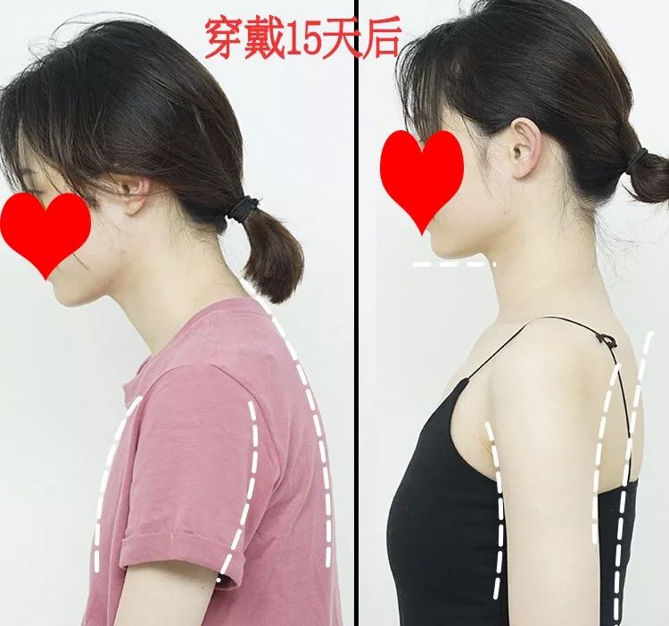 改善含胸驼背的最有效方法10分钟,改善含胸驼背的最有效方法完整版