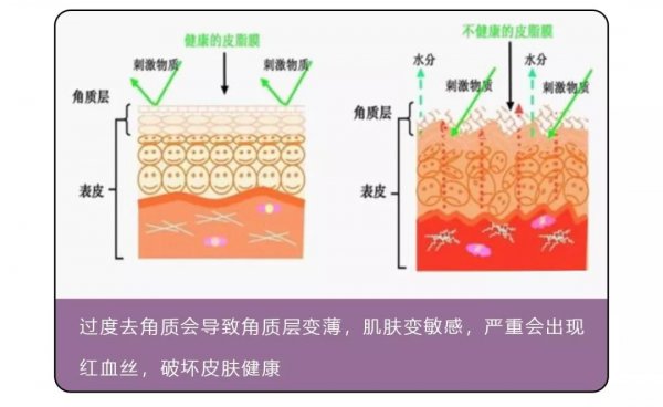 洗澡搓出泥的正确方法,洗澡搓下来的泥是什么