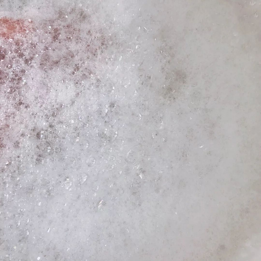 一瓶水止痒,后背长痱子很痒怎么解决