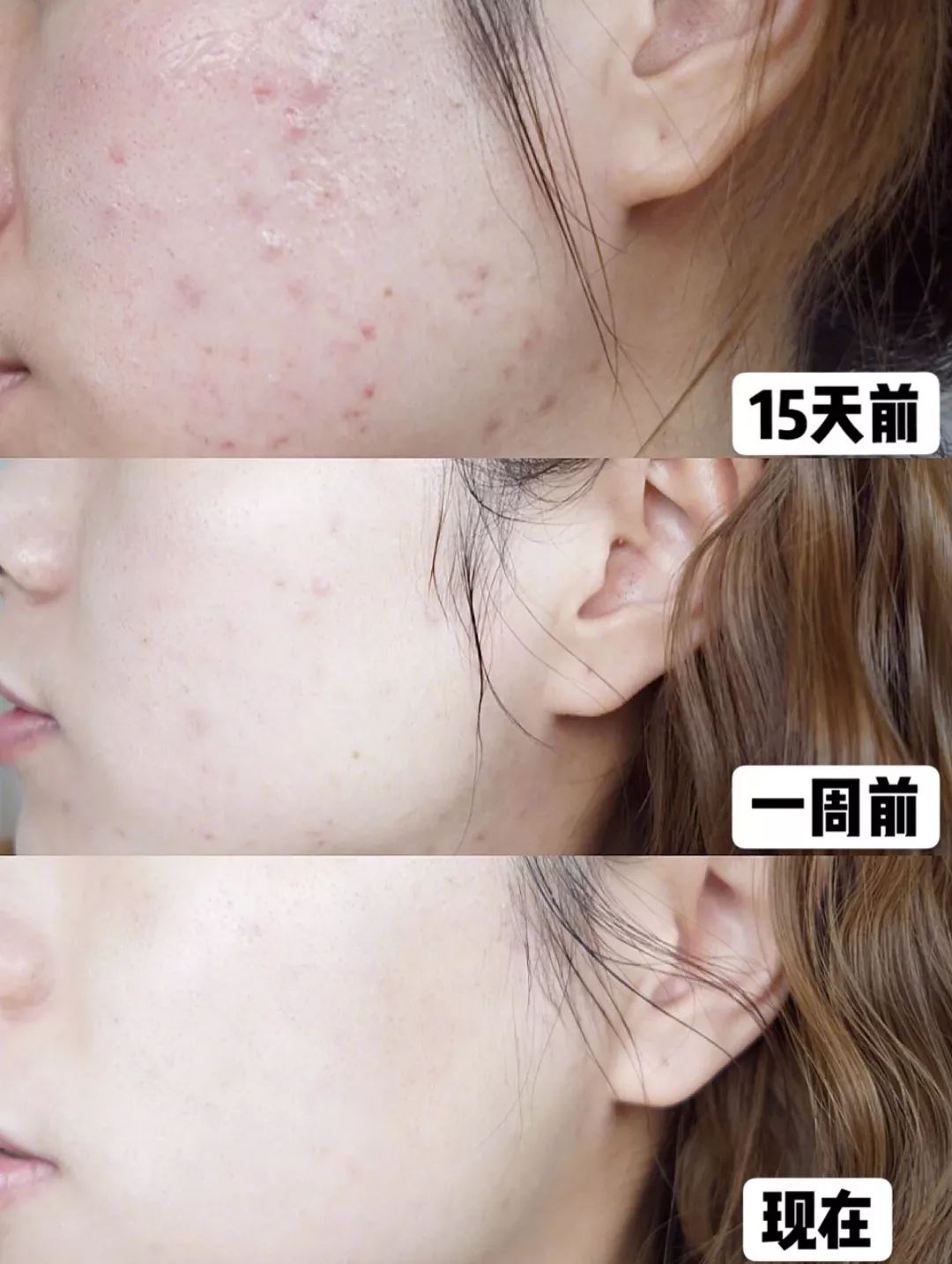 为什么能从鼻头上挤出白色的东西,鼻子挤出来的白丝是什么