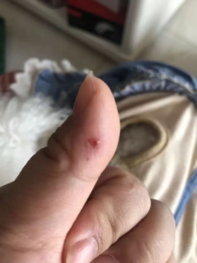 小区流浪狗咬伤20多人,苏州流浪狗被咬视频