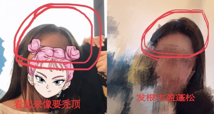 蓬松神器让头发立马蓬松,头发蓬松神器顶发根