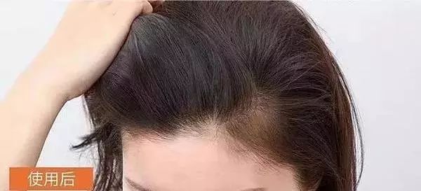 蓬松神器让头发立马蓬松,头发蓬松神器顶发根