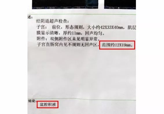 妇科病反复发作与劳累过度有关吗,六种妇科病无需过度治疗
