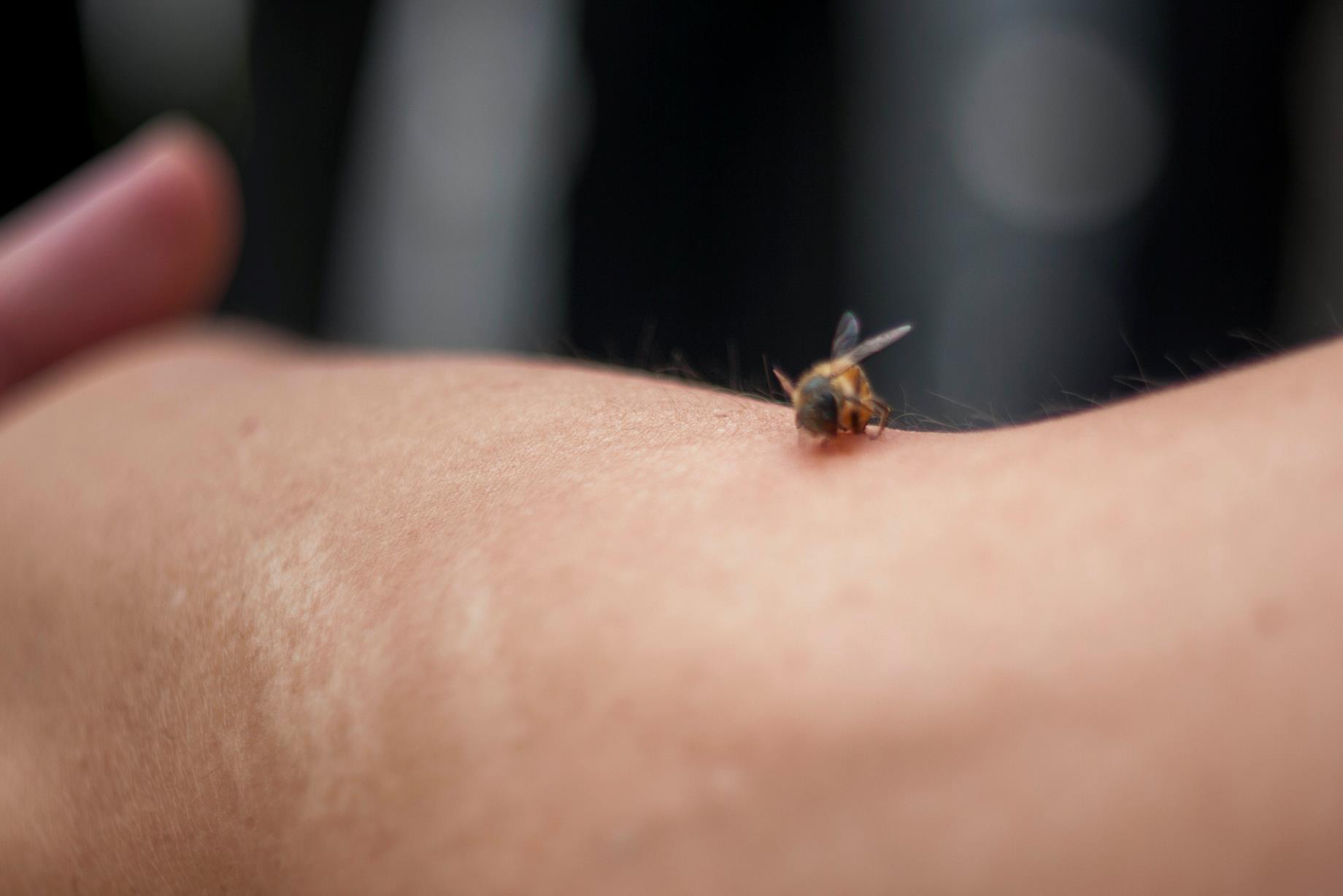 怎样分辨俄罗斯蜂蜜真假,权威专家蜂蜜真假鉴别最简单方法