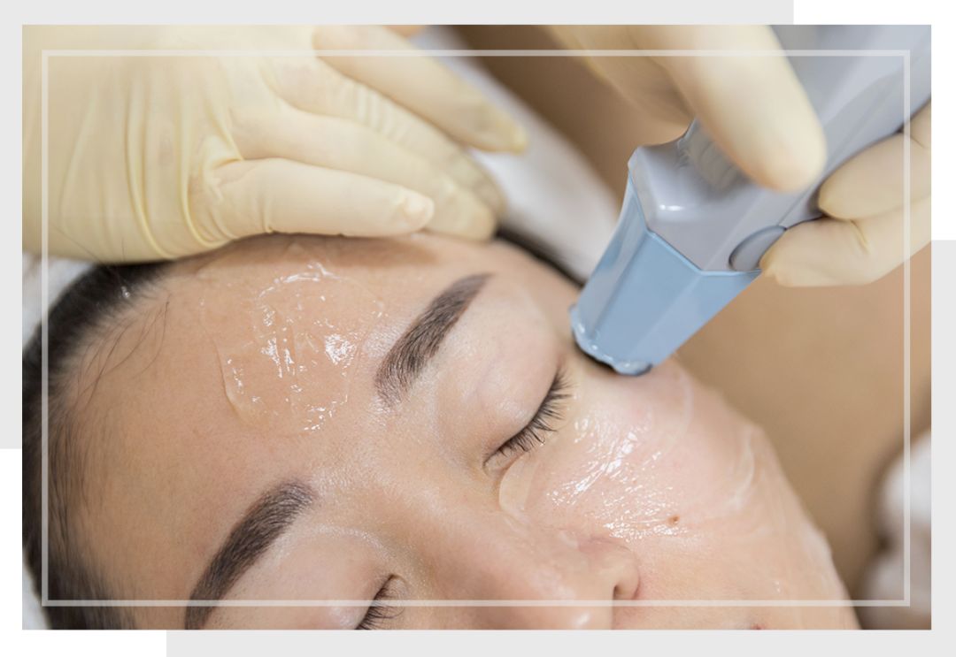 面部提拉无针埋线,无针埋线有护肤效果吗