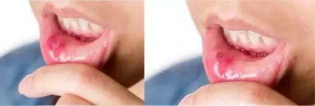 俄罗斯牙膏美白去口臭牙黄,去牙垢黄牙的牙膏测评