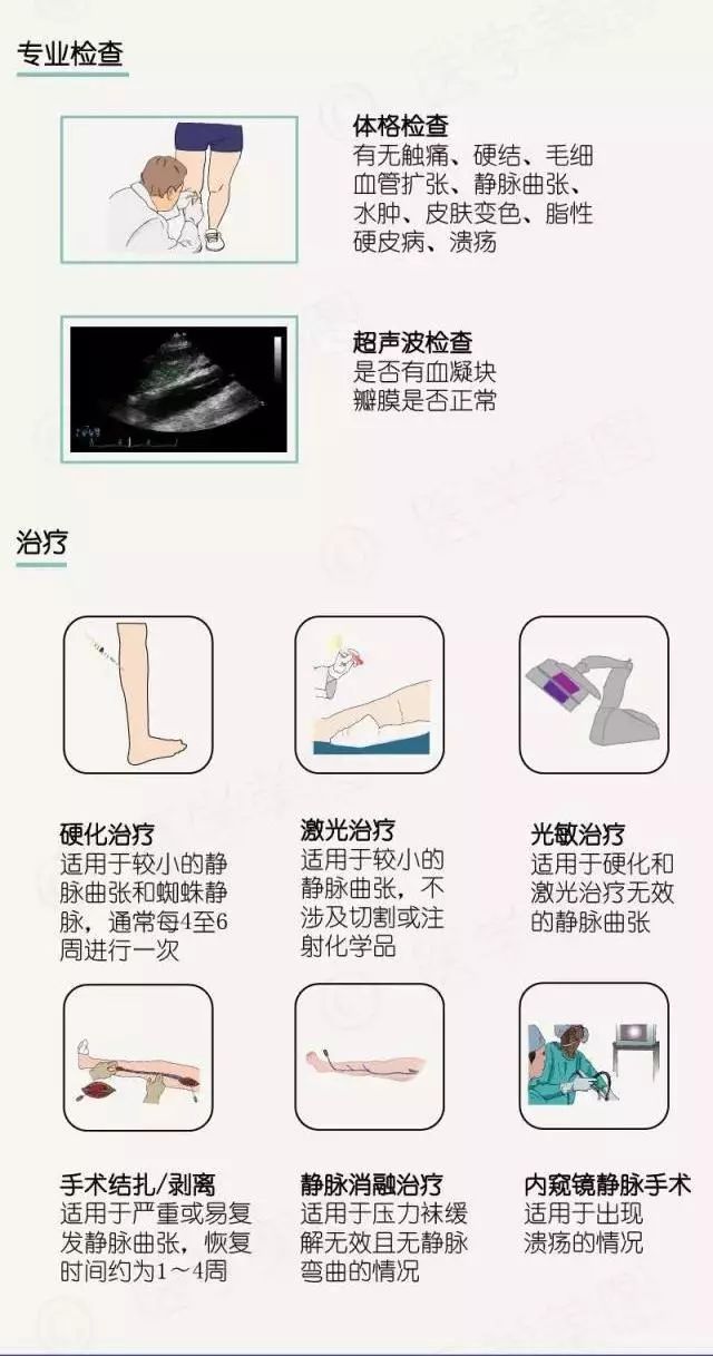 静脉曲张科普视频,关于下肢静脉曲张你知道多少