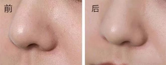 脸不干净有啥洗面奶好用,脸洗不干净用的护肤品