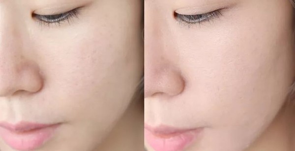 油皮气垫遮瑕持久不脱第一名,大牌气垫遮瑕持久不脱