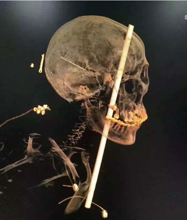 小区外墙瓷砖脱落情况报告,外墙瓷砖脱落居民心惊胆战