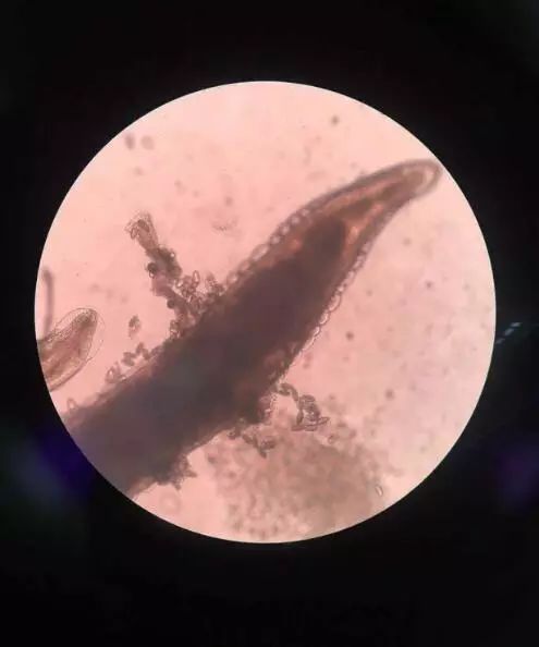 4岁小女孩屁屁痒，妈妈脱下裤子检查后吓坏了：一粒粒竟还会动