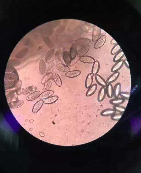 孩子屁股痒怎样快速止痒,孩子晚上屁股痒怎么快速止痒