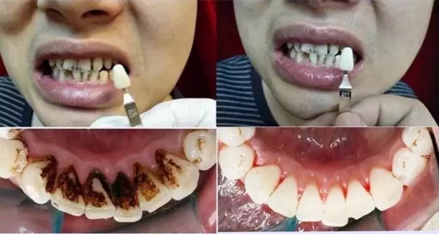 俄罗斯牙膏去黄牙怎么样,祛牙垢黄牙的牙膏国货之光