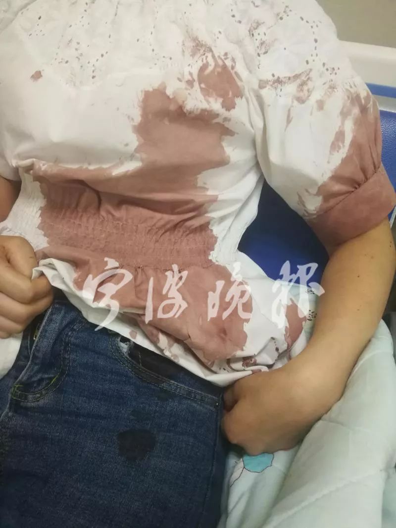 男孩遭两只大狗撕咬半小时后续,小孩被狗撕咬自家狗保护