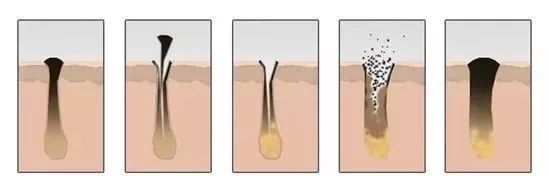 拜托女孩子这个部位千万不能黑！实在太尴尬了