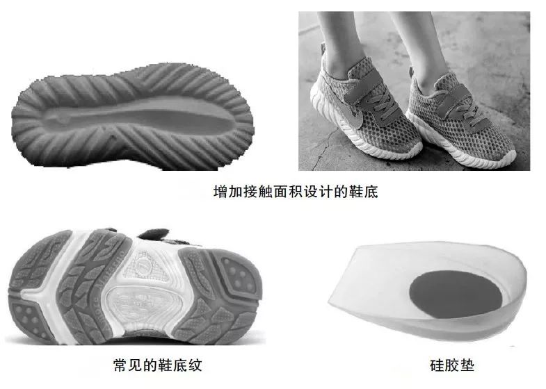 罗马脚埃及脚希腊脚的区别,罗马脚和希腊脚香港脚