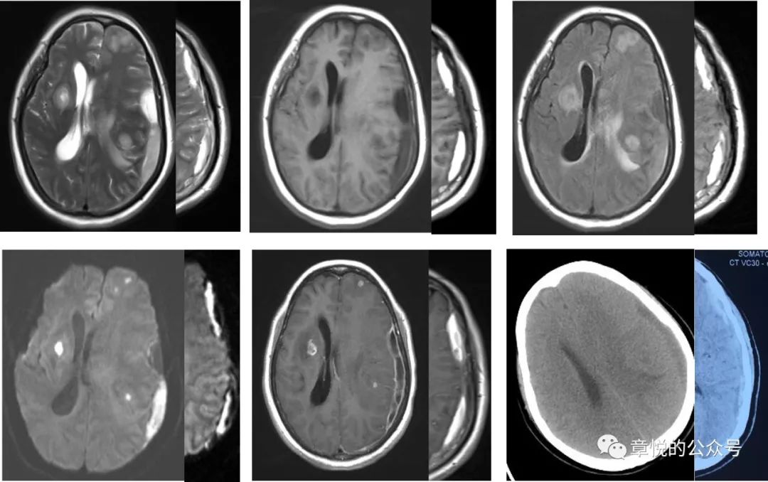 「章悦故事汇」华山“一针灵”