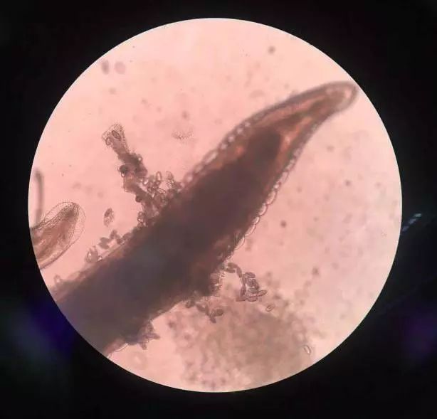 宝宝夜晚哭闹打虫,夜里宝宝屁股里爬出小白虫