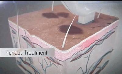 晒后急救小妙招自制面膜,晒后急救处理方法