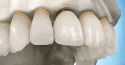 福州市民凭身份证免费牙齿矫正,身份证520开头免票