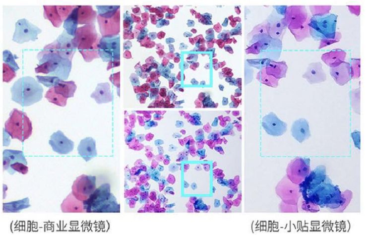 贴上它手机镜头秒变显微镜,贴在手机上的显微镜