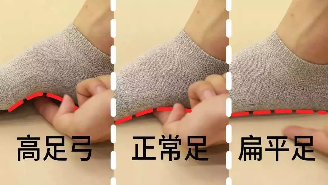 袜子掉跟小妙招怎么解决,袜子老是掉下去怎么办