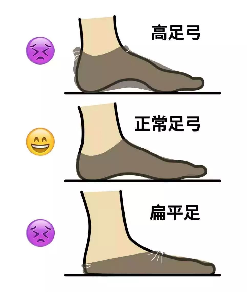 袜子总是往下掉小窍门,袜子老是脱落有什么办法补救