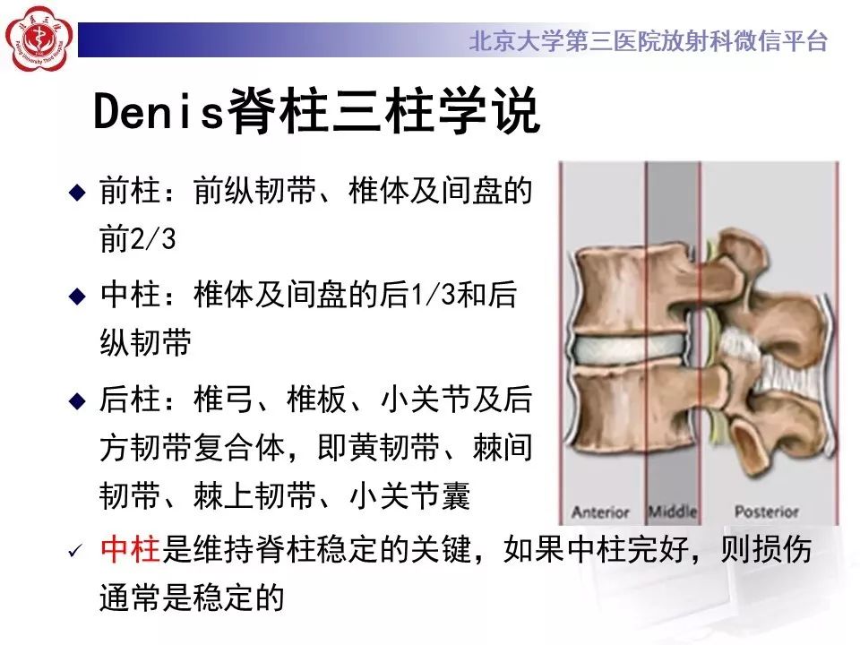 「每日一例｜893例」女，49岁，摔伤致腰部疼痛，活动受限1天