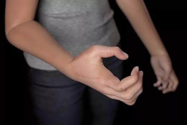 弯腰驼背的人是什么样的人,弯腰驼背的人长什么样