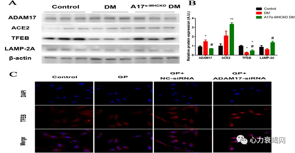 「2019CIHFC」张运教授:ADAM17—糖尿病性心肌病干预的新靶点