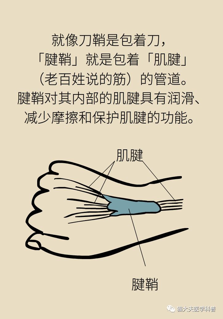 手腕长腱鞘囊肿,小孩手腕起了一个腱鞘囊肿要紧吗