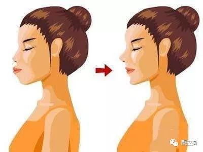 下巴后缩怎么办矫正,下巴后缩怎么办