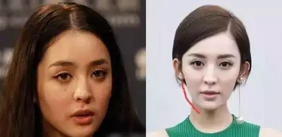 黑科技一秒祛斑,黑科技美白真的有效吗