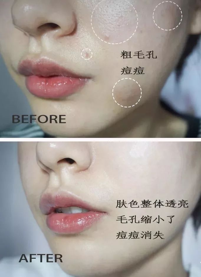 黑科技一秒祛斑,黑科技美白真的有效吗