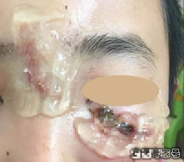 别当它是万能的！乐清人家里几乎都有，一定要谨慎使用……