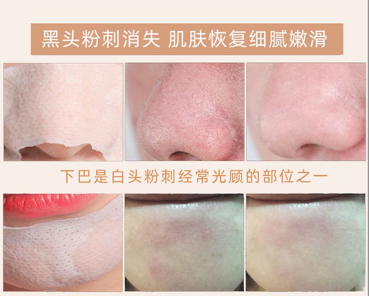 鸡蛋清除黑头,快速物理去黑头