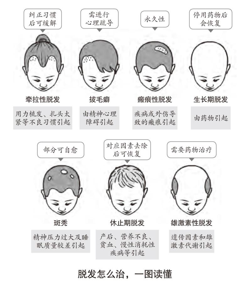 脱发治疗跟毛囊治疗是一样的吗,脱发治疗的真实记录