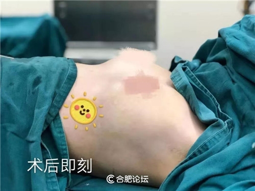 全能美女的美胸蜕变用实力碾压“平胸更时尚”的柠檬精